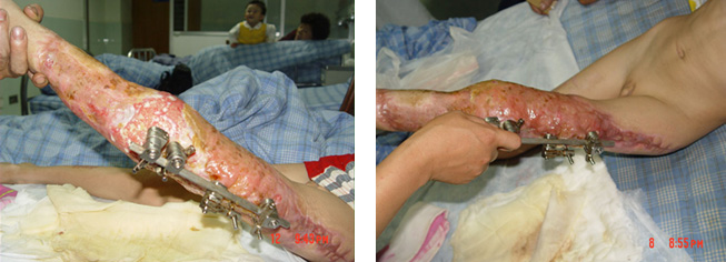 新宝GG—创立事业平台