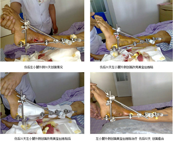新宝GG—创立事业平台